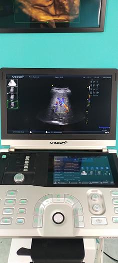 Gebraucht Vinno5 Ultraschallgerät mit 1 Sonde