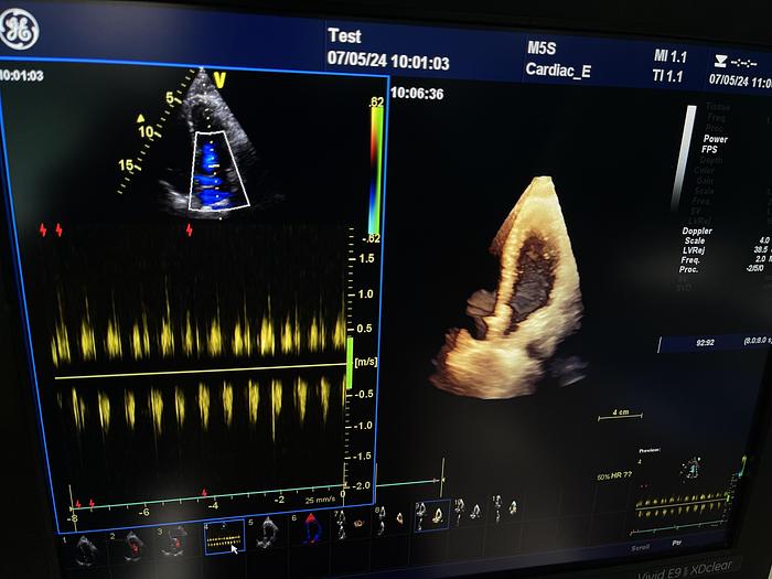 Gebraucht GE Vivid E9 XDClear Ultraschallgerät mit 2 Sonden