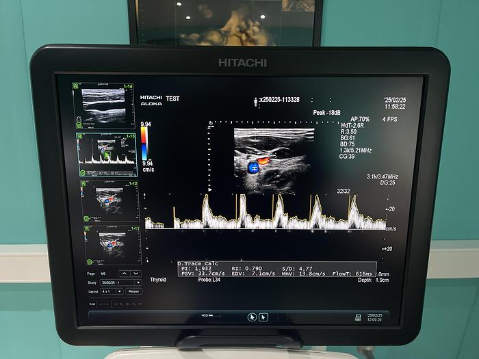 Gebraucht Hitachi ALOKA Arietta V70 Ultraschallgerät mit zwei Sonden und Fußschalter