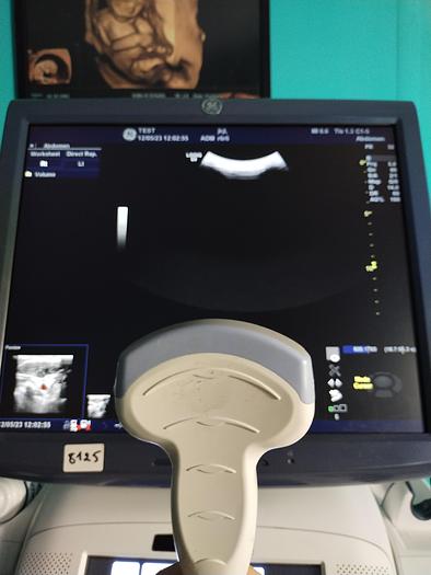 Gebraucht GE LOGIQ E9 Flachbildschirm-Ultraschallgerät inkl. 1 Sonde, Drucker und DVD-Brenner