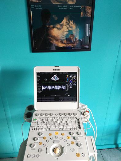 Gebraucht Philips CX50 Ultrasound with S5-1 and Trolly