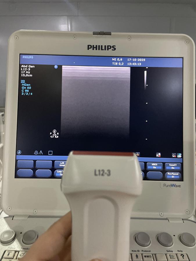 Gebraucht Philips L12-3 Linear Ultraschallsonde