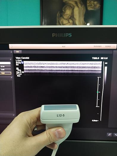 Gebraucht Ultraschallgerät Philips EPIQ 5