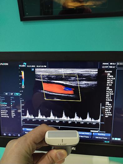 Gebraucht Alpinion ECUBE 5 Flachbildschirm-Ultraschallgerät inkl. 2 sonden Ultrasound