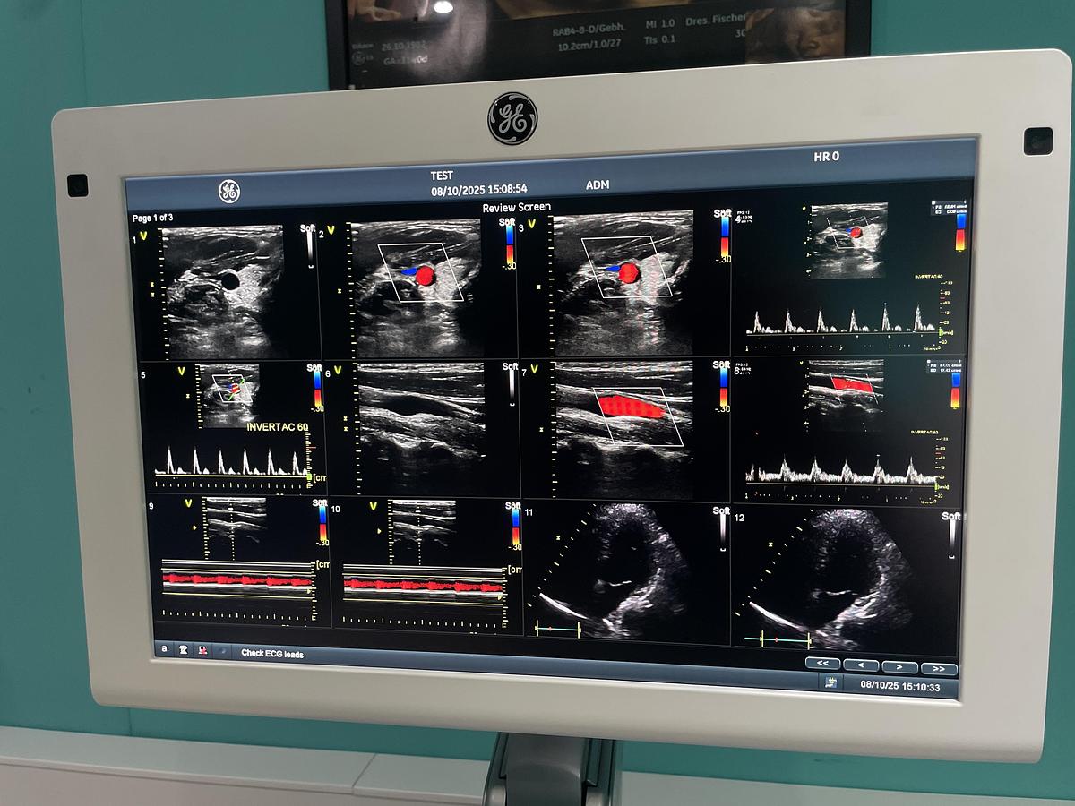 Gebraucht GE Vivid S70 Ultraschallgerät mit zwei Sonden