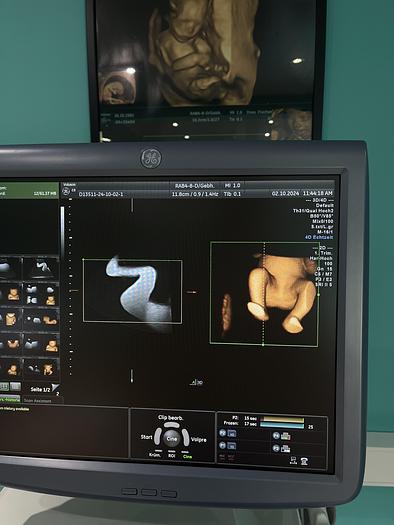 Used GE Voluson E8 Ultraschallgerät mit zwei Sonden und Drucker