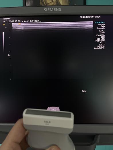 Gebraucht HELX Evoulution Acusion S2000 von Siemens Ultraschall Gerät mit drei Sonden