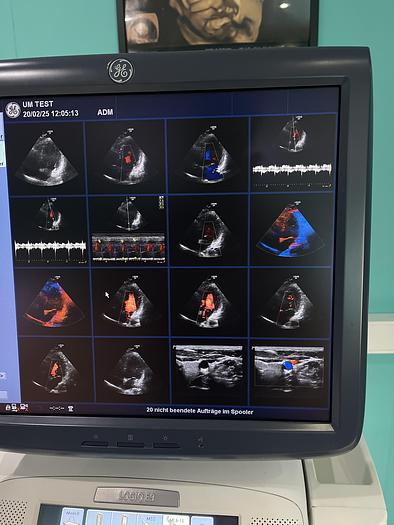 Gebraucht GE LOGIQ E9 Ultraschallgerät mit 2 Sonden und Drucker 