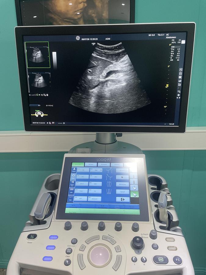 Gebraucht GE LOGIQ P7 Ultraschallgerät mit zwei Sonden