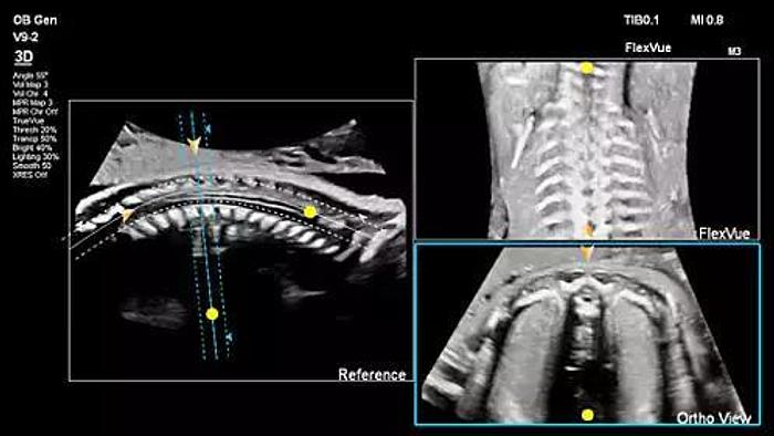 Philips Affiniti 70 Farbdoppler Ultraschallgerät