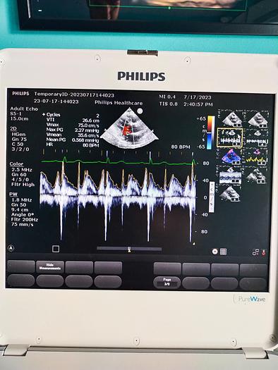 Gebraucht Philips CX50 Ultrasound with S5-1 and Trolly
