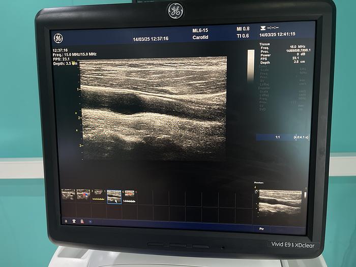 Gebraucht  GE ML6-15-D Ultraschallsonde