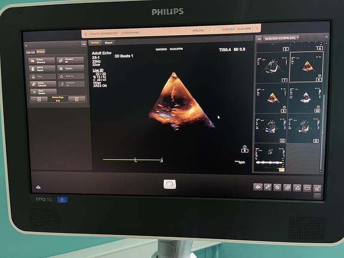 Used Philips X5-1 Sektor Ultraschallsonde