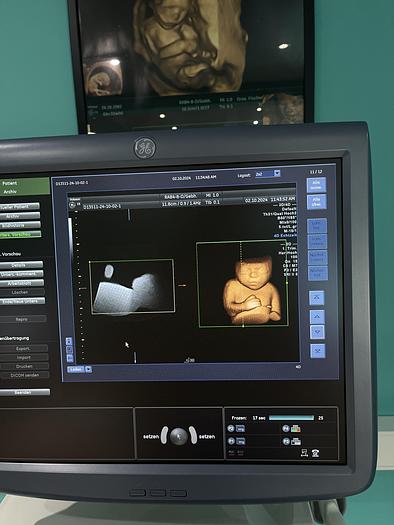 Used GE Voluson E8 Ultraschallgerät mit zwei Sonden und Drucker