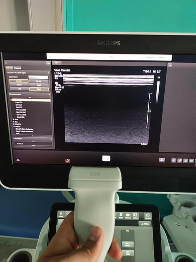 Gebraucht Philips L12-5 Ultraschallsonde