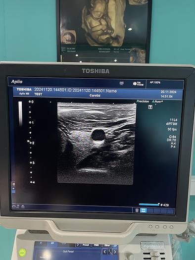 Used Toshiba Aplio 400 Ultraschallgerät mit 2 Sonden