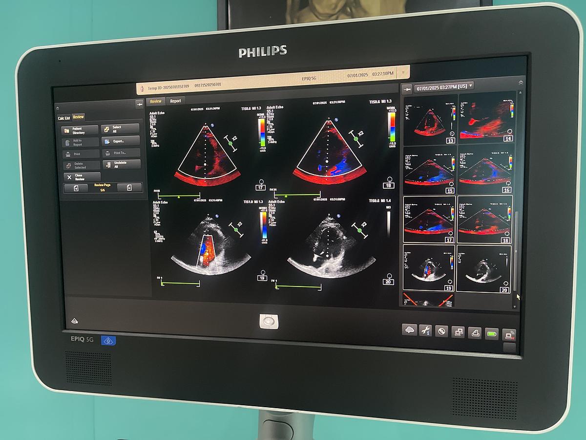 Gebraucht Philips EPIQ 5G Elite B Version Ultraschallgerät mit zwei Sonden