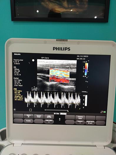 Gebraucht Philips CX50 Ultraschallgerät