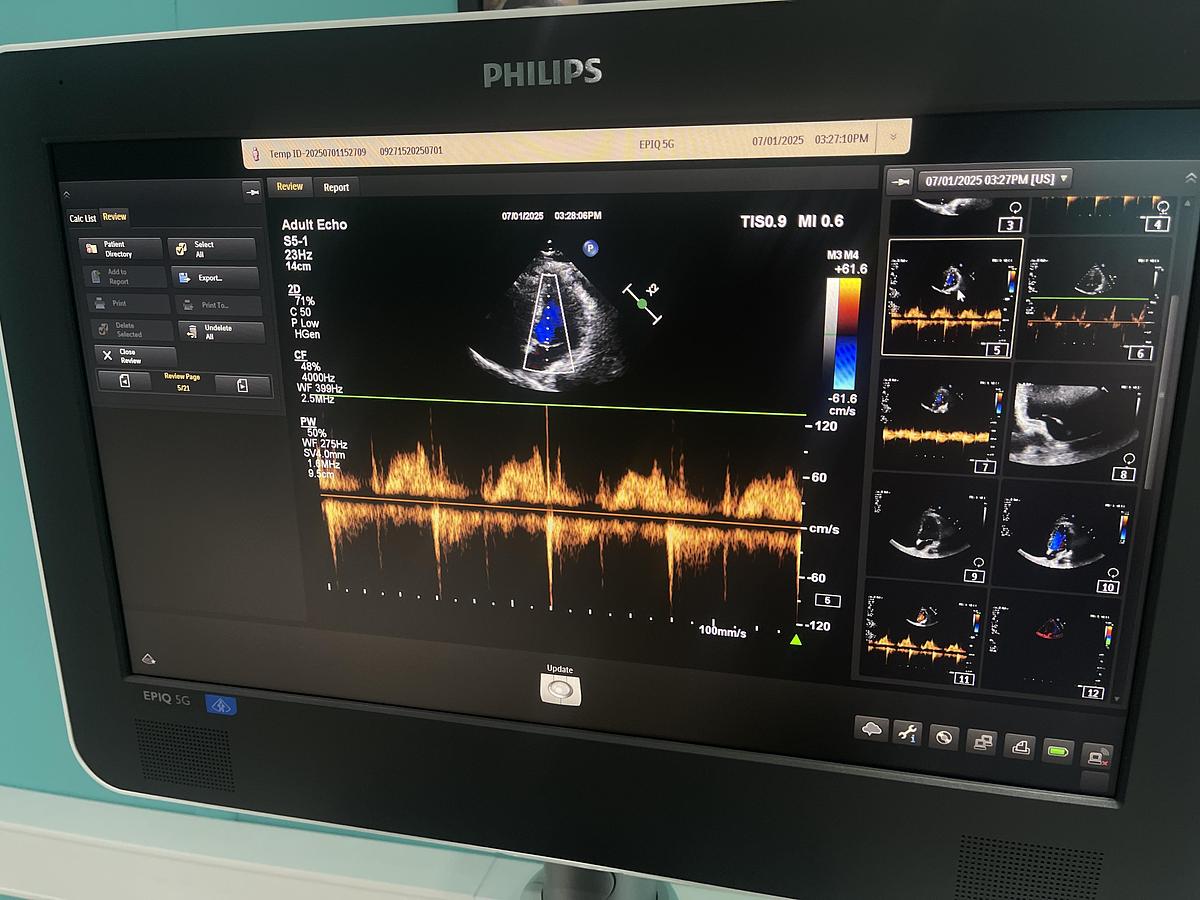 Gebraucht Philips EPIQ 5G Elite B Version Ultraschallgerät mit zwei Sonden