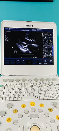 Gebraucht philips ultrasound cx50 mit 2 Sonde linear und sektor
