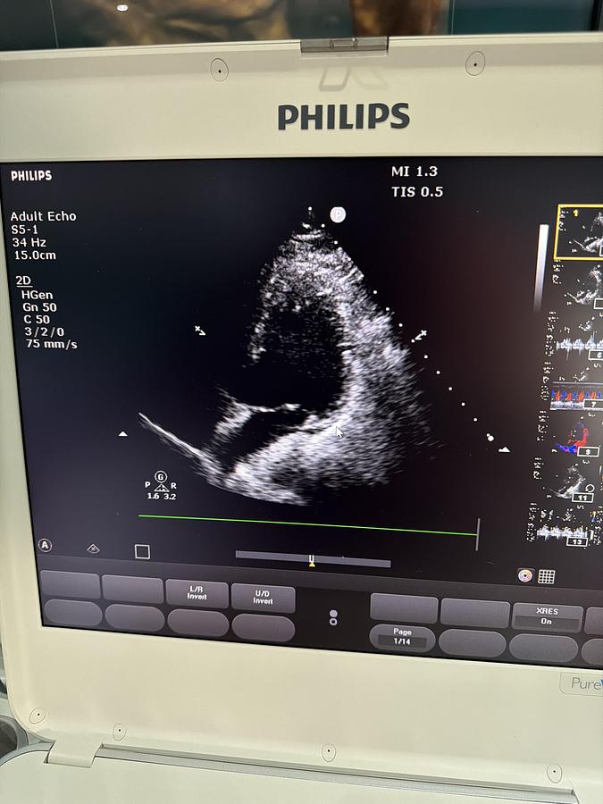 Gebraucht Philips CX50 Ultraschallgerät mit Sonde C.1