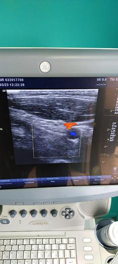 Gebraucht GE 10L Linear Ultraschallsonde