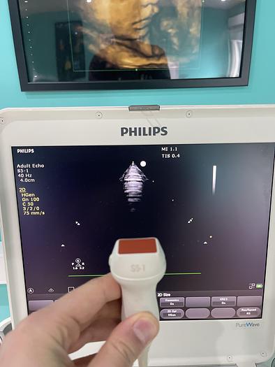 Gebraucht Philips CX50 Ultraschallgerät HW C.0 mit Sektor Sonde