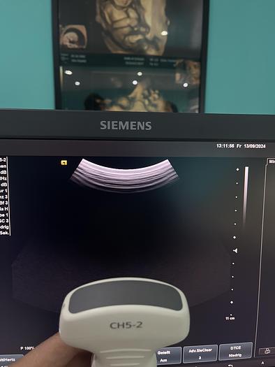 Used Siemens Acuson X600 Ultraschallgerät mit drei Sonden