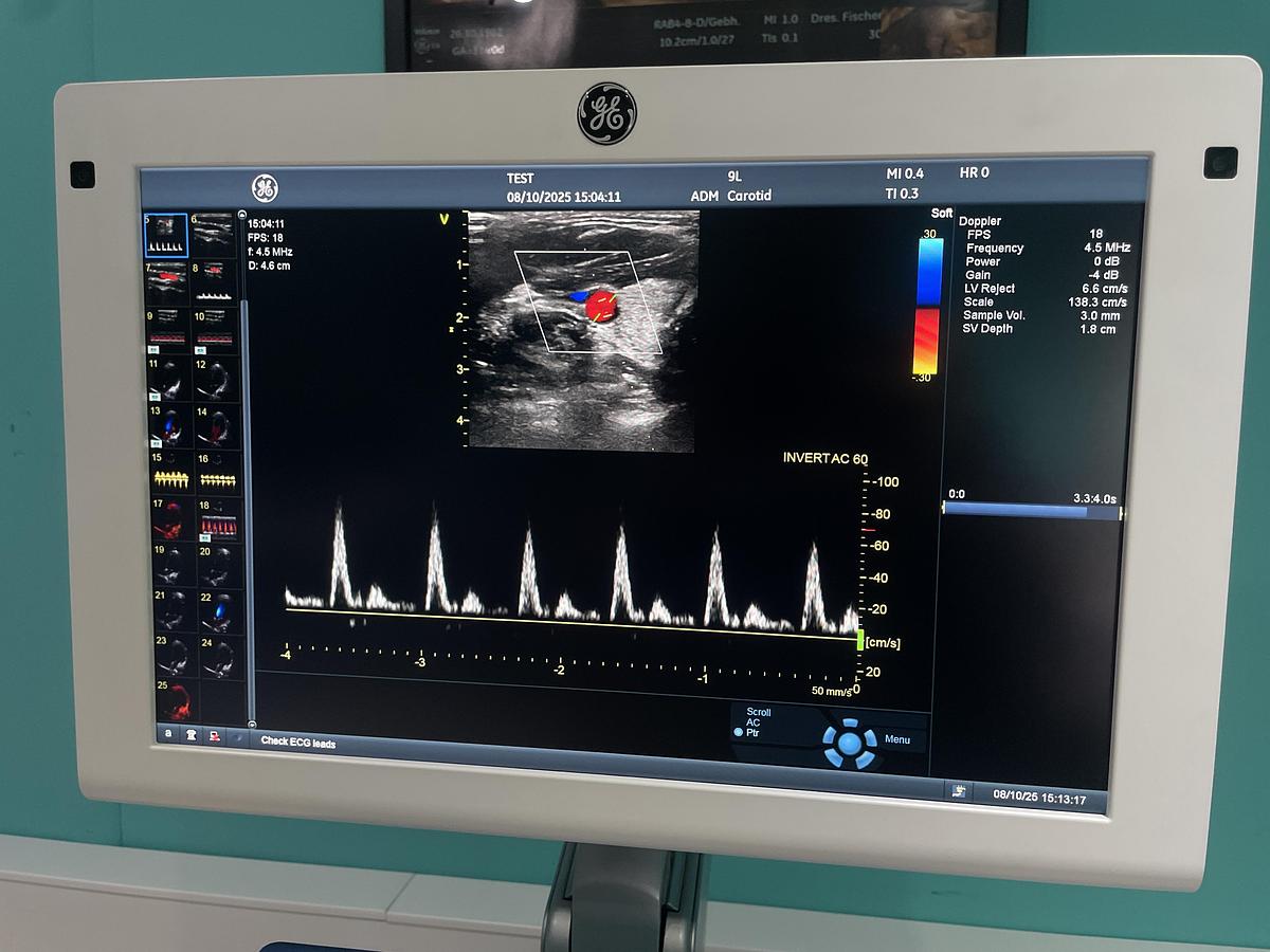 Gebraucht GE Vivid S70 Ultraschallgerät mit zwei Sonden
