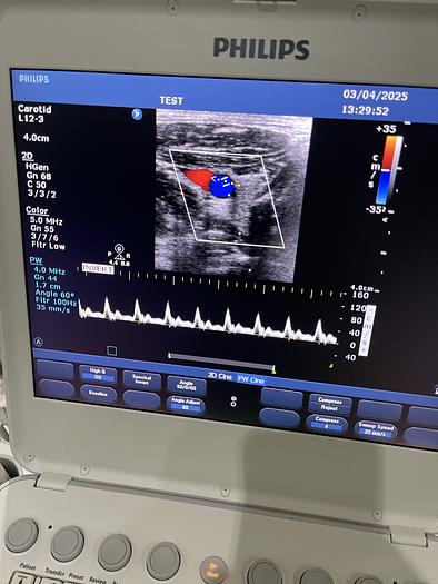 Gebraucht Philips L12-3 Linear Compact Ultraschallsonde 