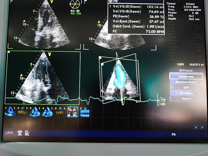 Gebraucht GE Vivid 7 Ultraschallgerät