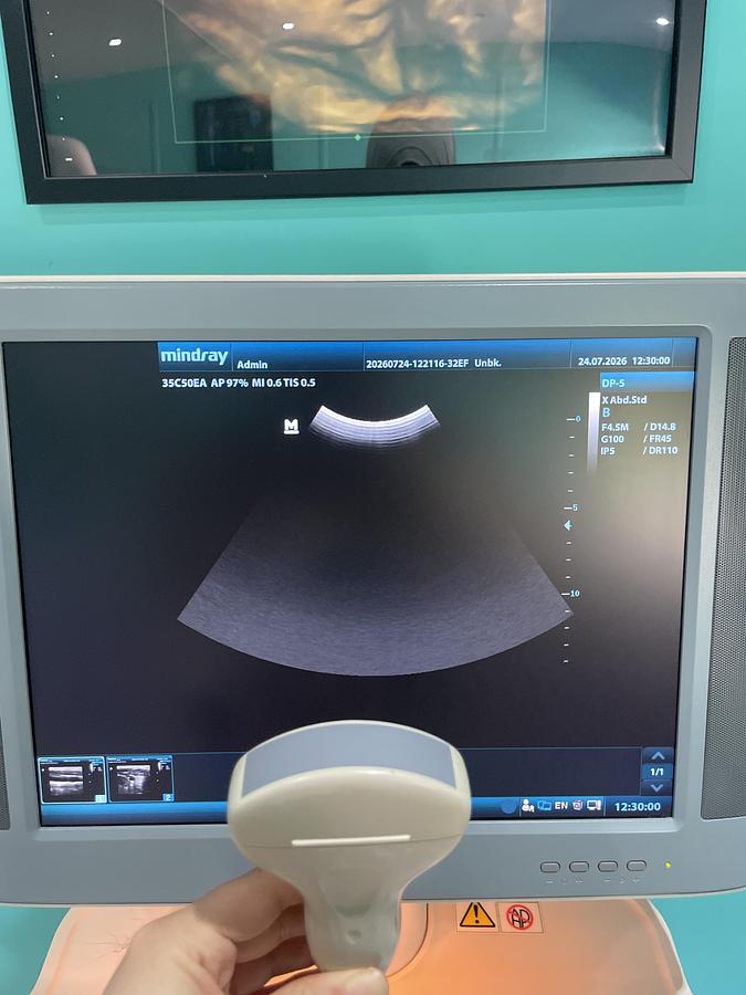 Gebraucht Mindray DP-5 Ultraschallgerät mit zwei Sonden und Drucker