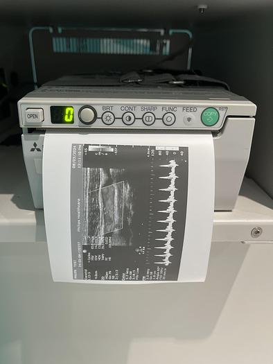 Gebraucht Philips HD15 Ultraschallgerät mit zwei Sonden 