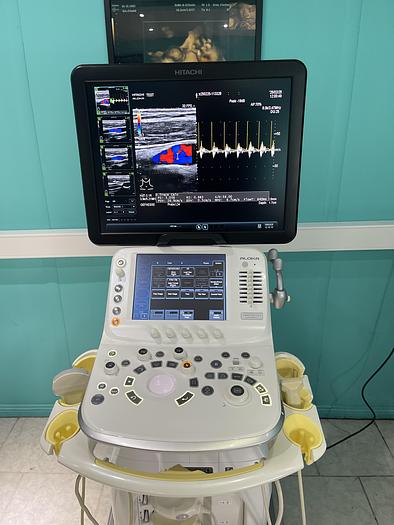 Gebraucht Hitachi ALOKA Arietta V70 Ultraschallgerät mit zwei Sonden und Fußschalter