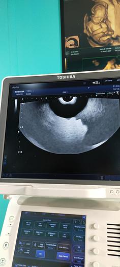 Gebraucht Toshiba Aplio 500 Ultraschallgerät mit 3 Sonden