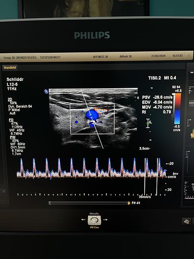 Used Philips Affiniti 30 Ultraschallgerät mit 3 Sonden und Drucker