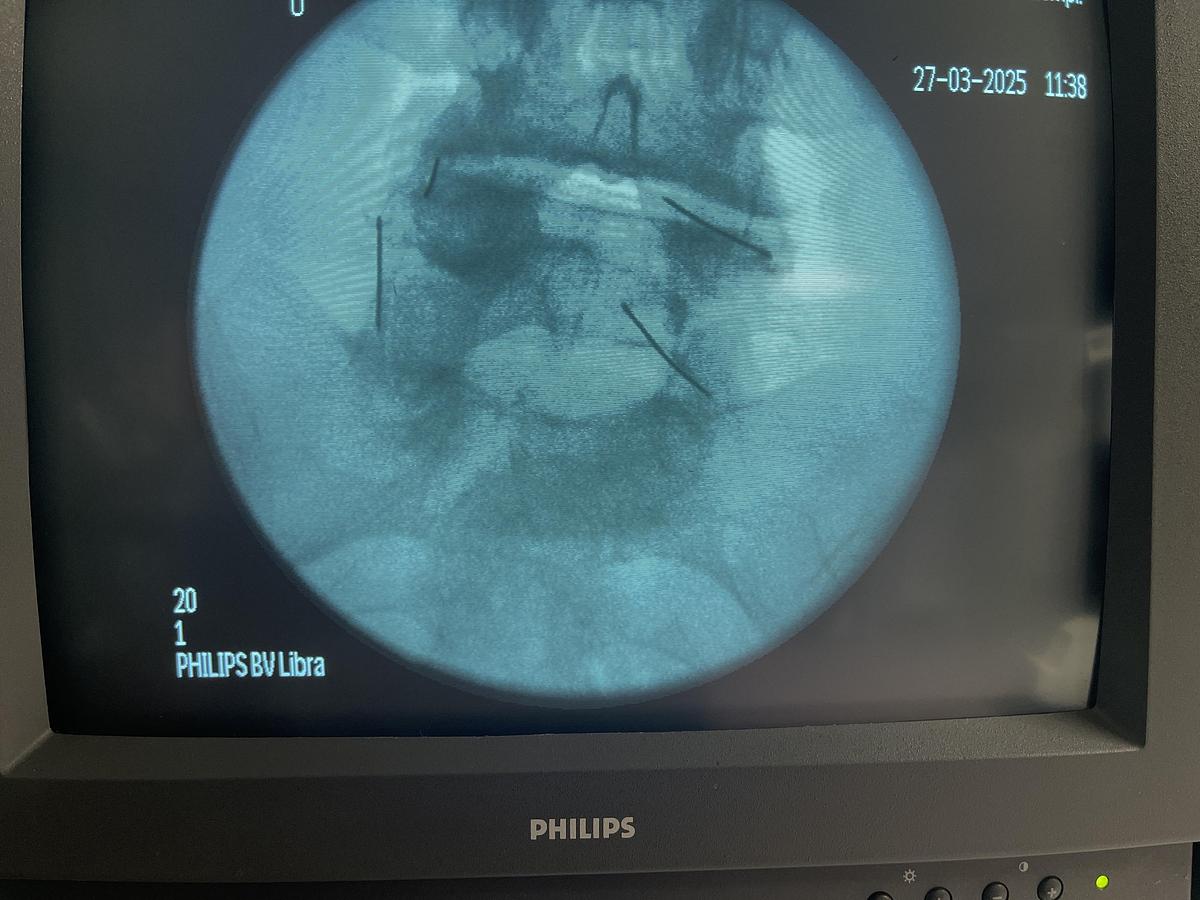 Used Philips BV Libra C-Bogen-System