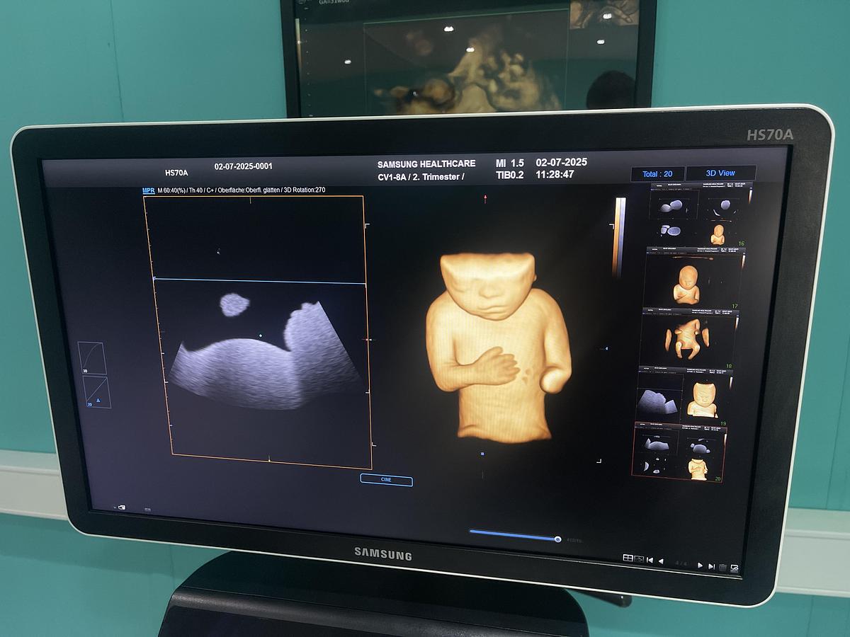 Gebraucht Samsung HS70A Ultraschallgerät mit drei Sonden