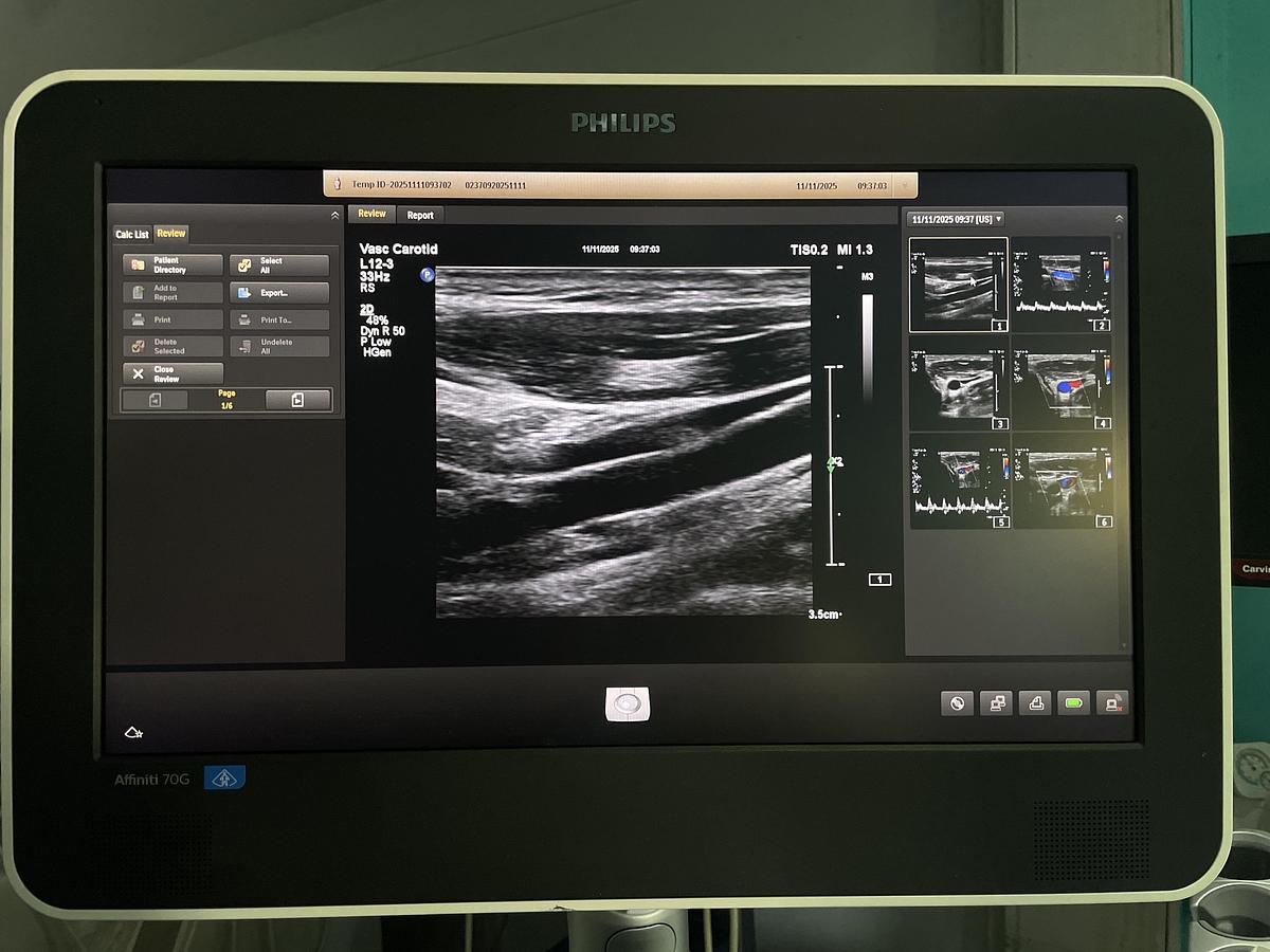 Gebraucht Philips L12-3 Linear Ultraschallsonde 