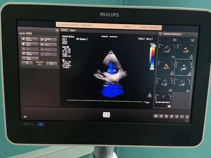 Used Philips X5-1 Sektor Ultraschallsonde