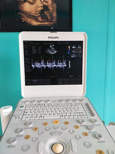 Gebraucht Philips CX50 Flat Screen Ultrasound Scanner