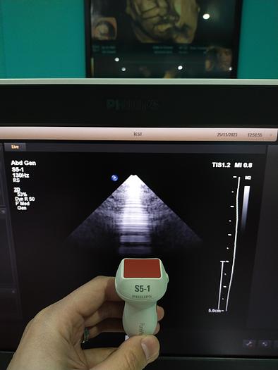 Gebraucht Ultraschallgerät Philips EPIQ 5
