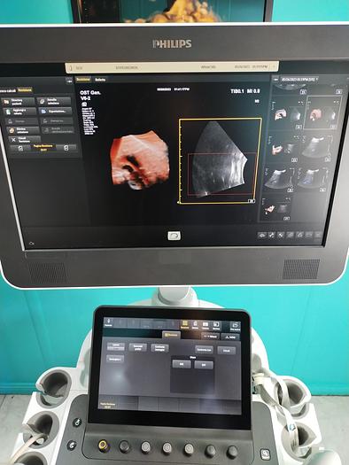 Gebraucht Philips V6-2  3D/4D  Volumen Ultraschallsonde