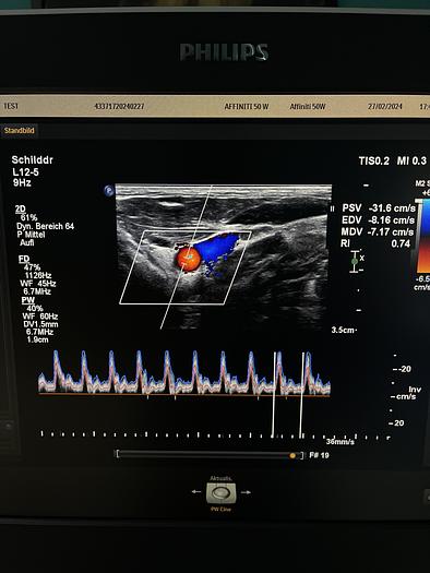 Gebraucht Philips Affiniti 50W Ultraschallgerät mit 3 Sonden und Drucker SV 9.0.5