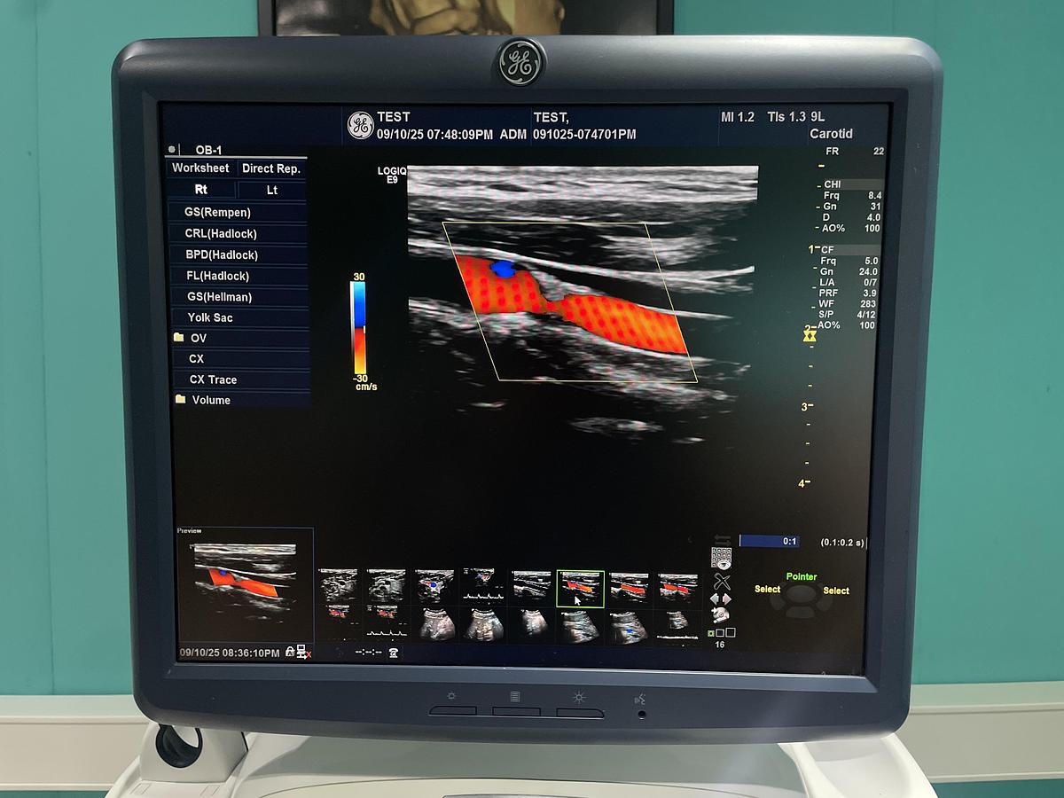 Gebraucht GE LOGIQ E9 Ultraschallgerät mit 2 Sonden und Drucker