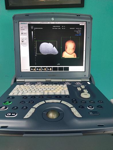 Gebraucht GE Voluson I Ultraschallgerät mit  4d Sonde und TV Sonde