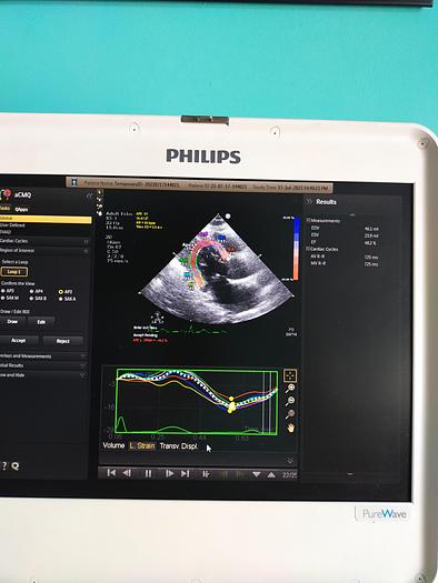 Gebraucht Philips CX50 Ultrasound with S5-1 and Trolly