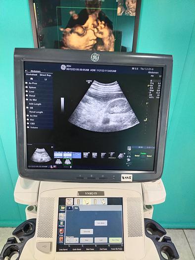 Gebraucht GE LOGIQ E9 Flachbildschirm-Ultraschallgerät