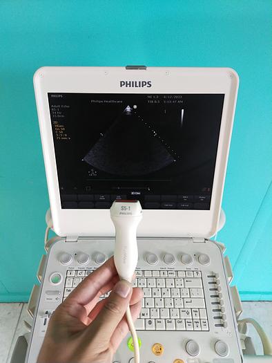 Gebraucht Philips CX50 Flat Screen Ultrasound Scanner