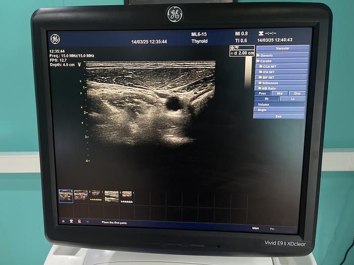 Gebraucht  GE ML6-15-D Ultraschallsonde